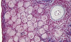 卵泡结构和发育阶段：始基卵泡与次级卵泡