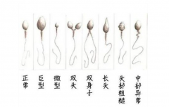 精子质量差不止是熬夜，这些因素很多人忽略|