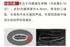 A/B/C型内膜，哪种胚胎宝宝更易着床？