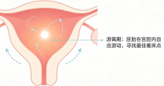 胚胎移植后在子宫内游离多久？它在忙什么